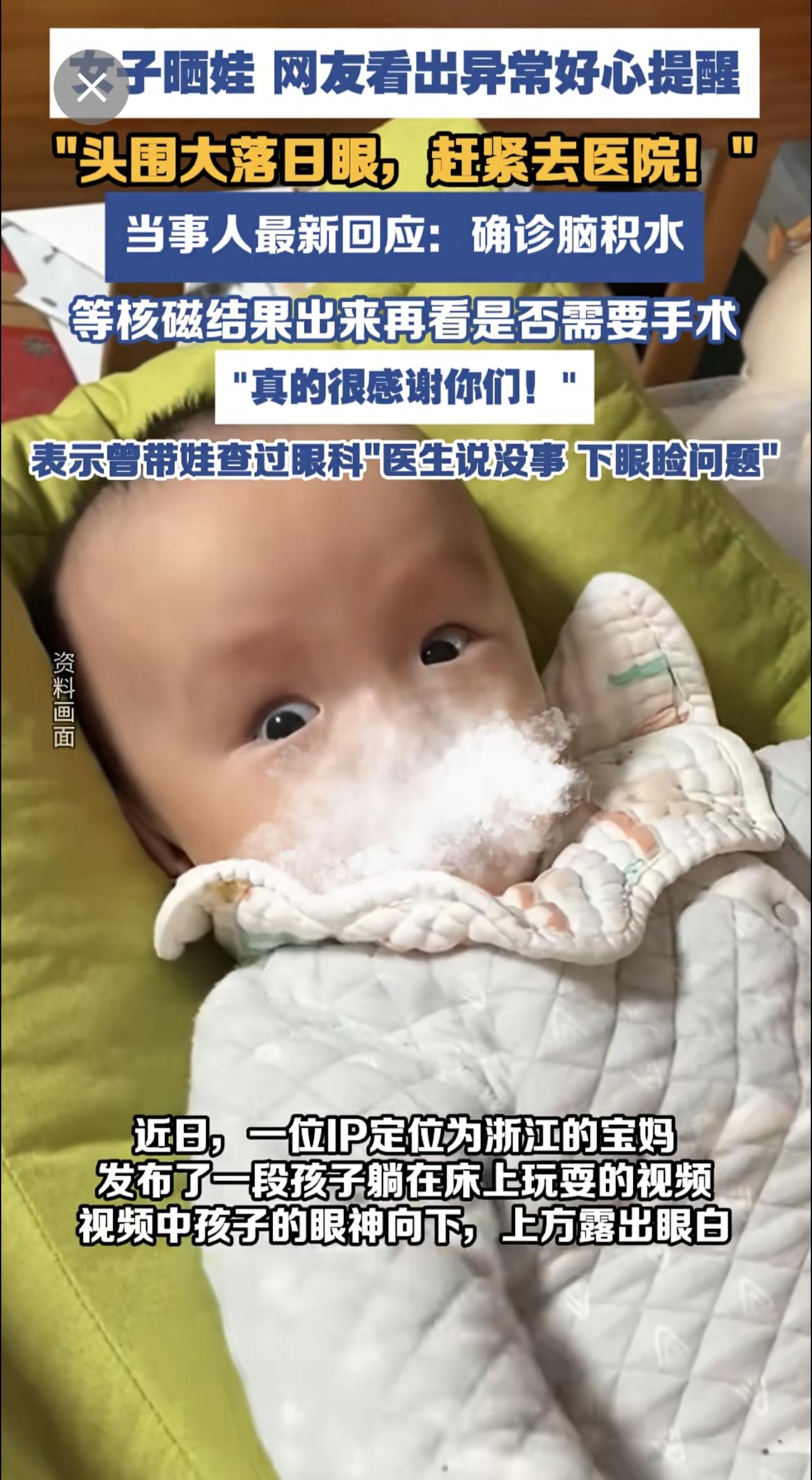 女子晒娃，网友看出异常好心提醒。当事人最新回应：确诊脑积水，等核磁结果出来再看是