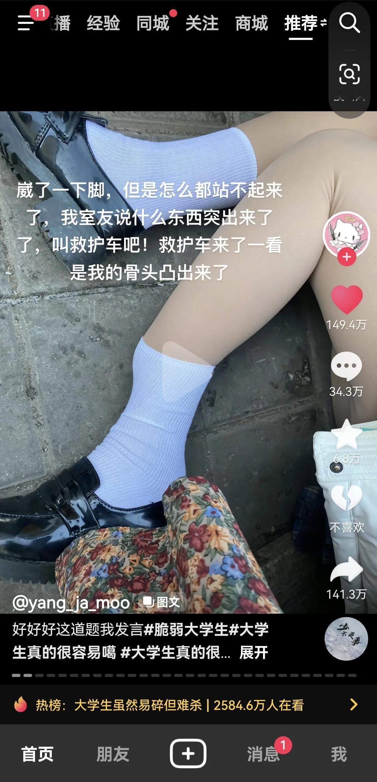 我那易碎易折的大学生们[我想静静]
现在的娃儿们身体看起来好脆弱啊
想起了当年上