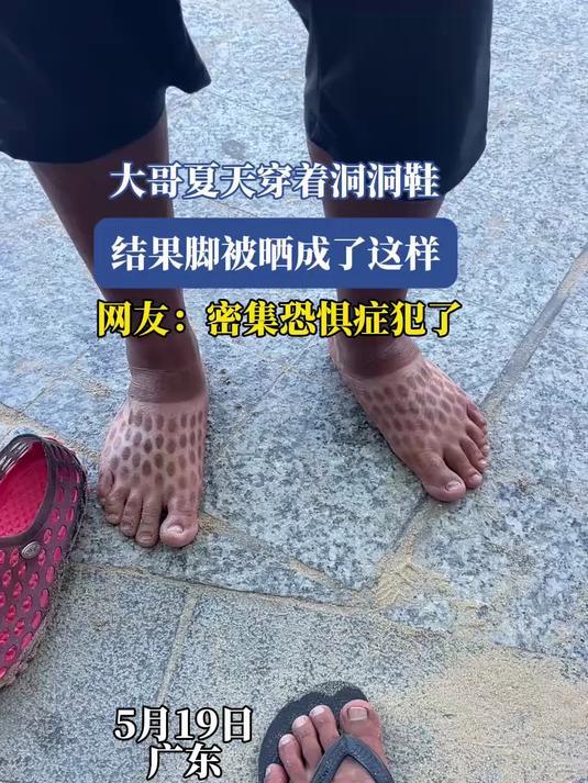 洞洞鞋突然卖不动了洞洞鞋巨头股价暴跌30%材质不咋地，而且还容易打滑[揣手]突然