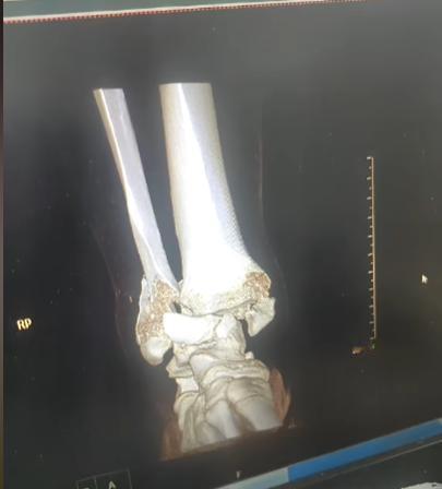 闲弓不要拉，闲马不要骑，闲人不要浪，闲球不要踢。
昨天晚上和朋友喝酒，聊起他十几