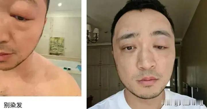 古怪精灵数小尼
柒发过敏眼不睁
爱美之心人皆有
粉丝为你好揪心

央视当红帅哥主