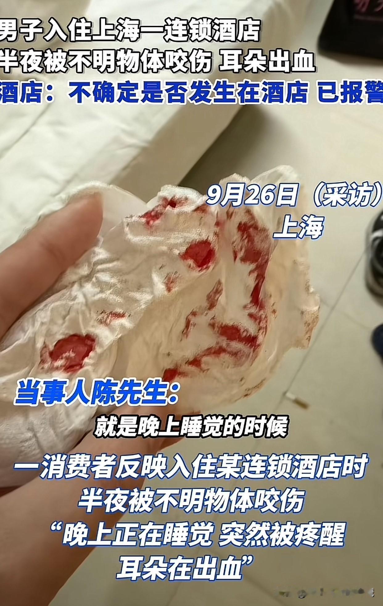 想想都让人头皮发麻！上海一男子在酒店睡觉，半夜耳朵被咬出血，医生判断很可能是老鼠