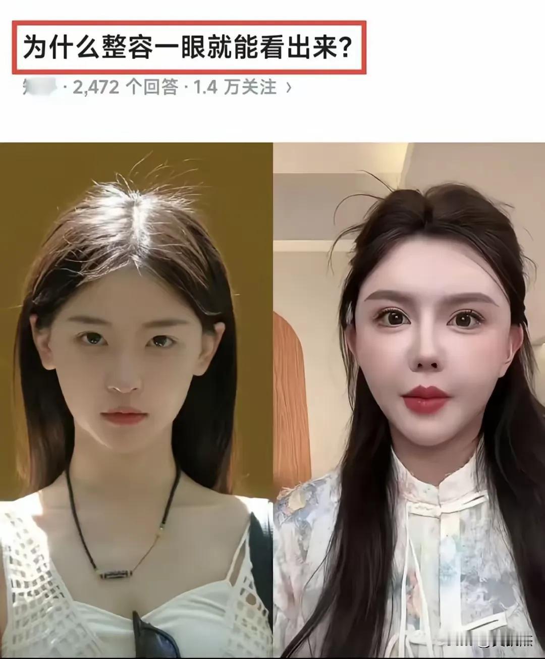 难道是我的审美有问题吗，为什么我觉得美女没整容之前比整容后更好看呢？

看到照片