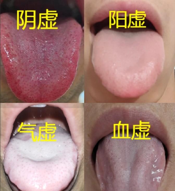 四大名汤大揭秘！看完秒懂中医养生精华 💪

听说过＂名门望族＂，今天咱们聊聊中
