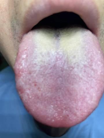 大兄弟才30出头，这身体还不如60岁老头好呢，看来平常没少干坏事啊！

我们来看