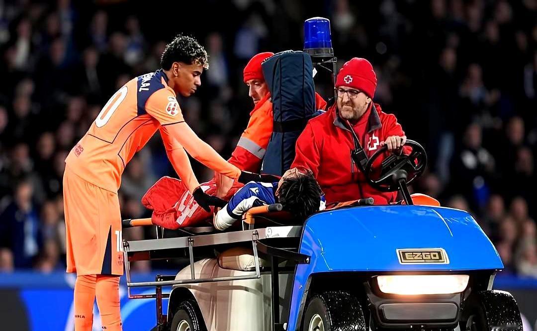 久保建英冲刺时大腿后侧“啪”一声，直接躺平，担架抬走。医生一句话：腘绳肌撕裂，世