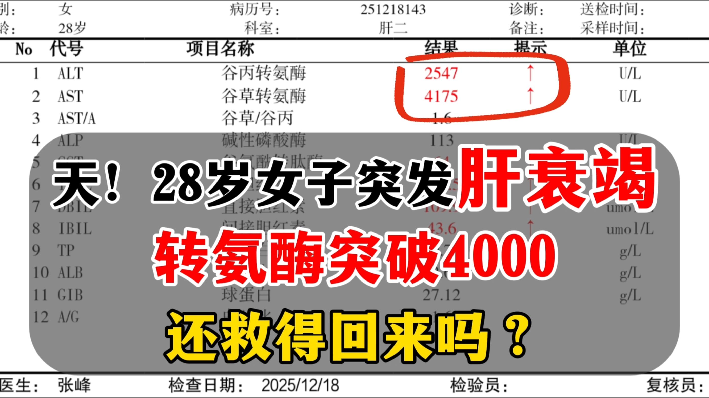 上周门诊来了一位患者，他是乙肝大三阳，平时没重视，结果现在熬成了急性肝...