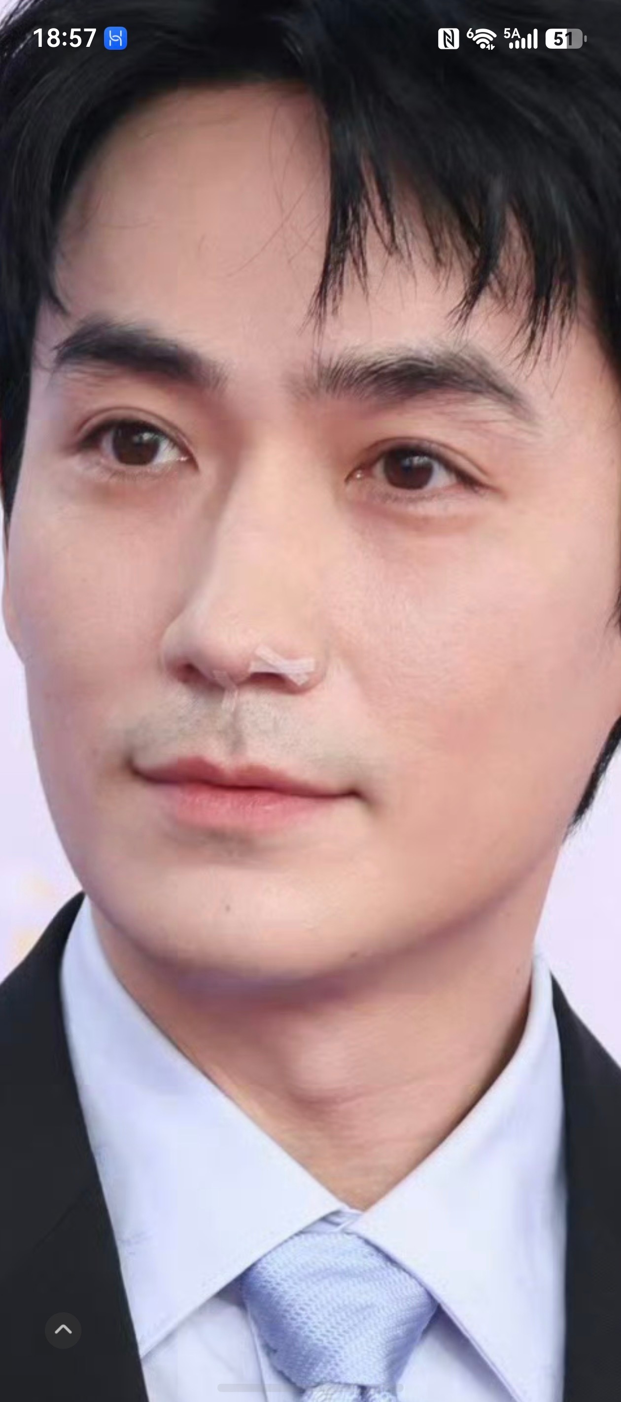 朱一龙鼻子肿了么 