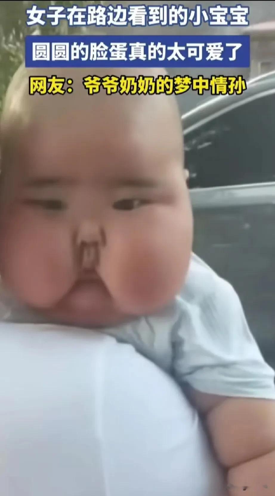 女子夸宝宝太可爱了，这跟可爱能搭上边吗？
养儿不易，但是不能随意，这孩子脸胖得嘴
