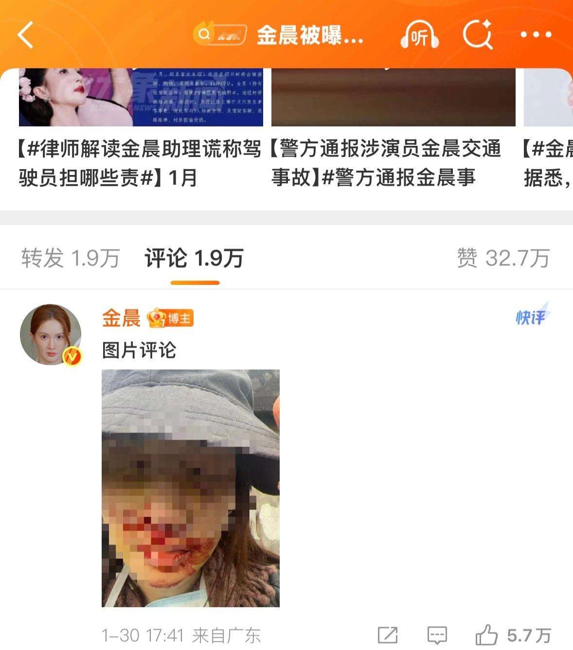 警方通报金晨事件这么严重我的天 血淋淋的1️⃣她是为了躲避动物 怕创似小动物 可