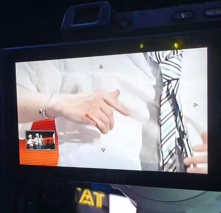 丁程鑫手被划伤丁程鑫被划伤了 有点危险啊 