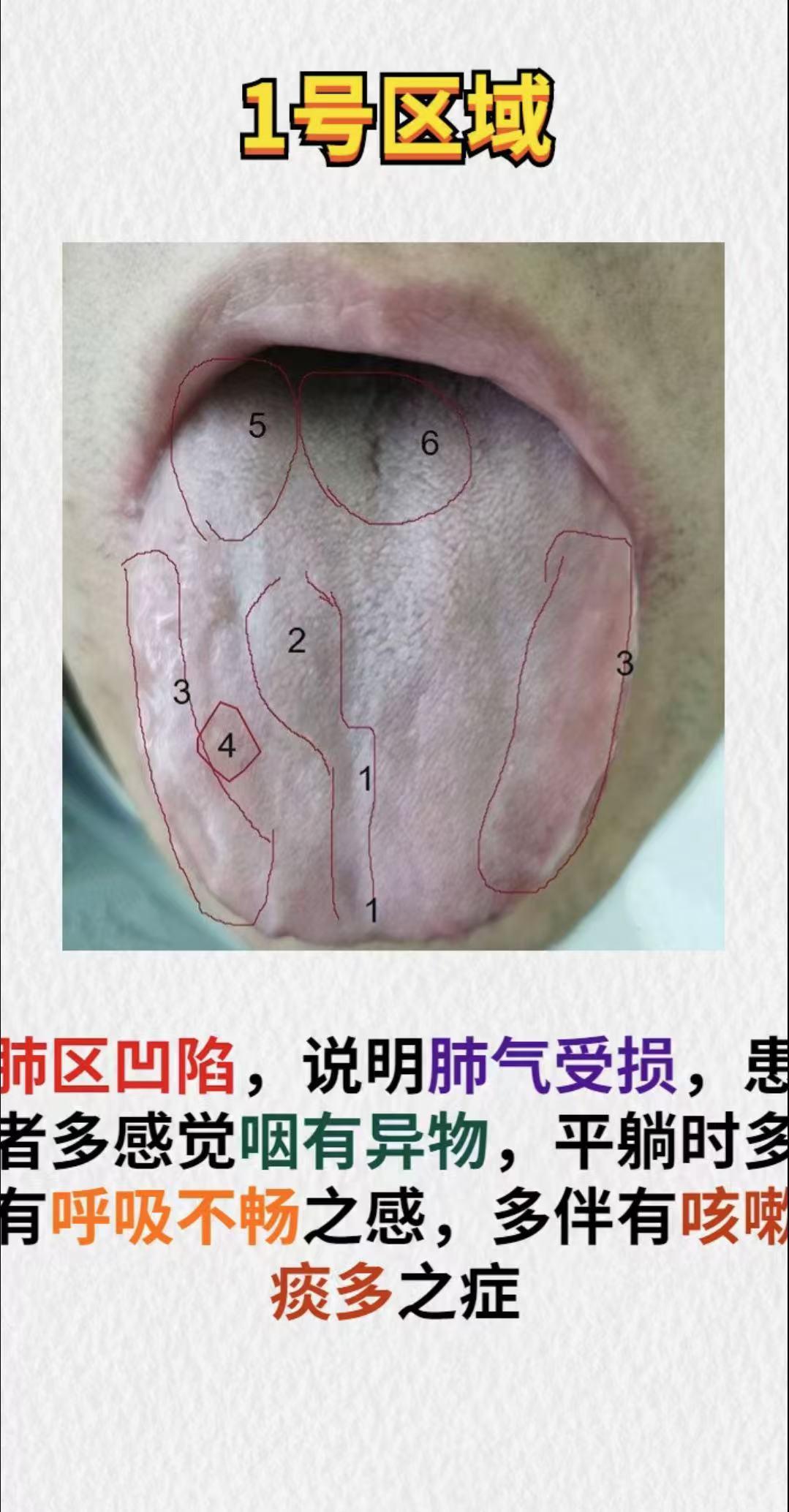 小小舌象别忽略，健康问题早知道，中医临床舌诊案例分析，快来学习！