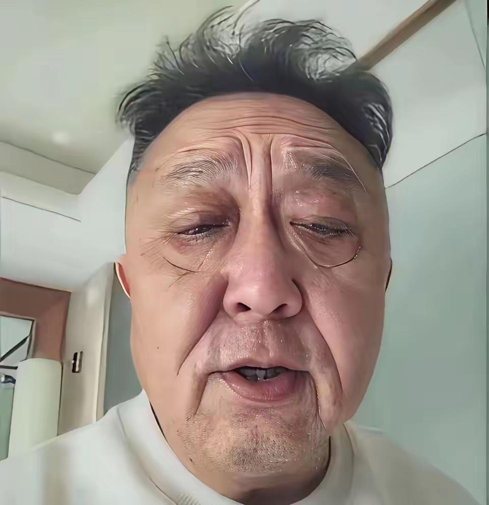 你手里的那根烟，嘴角那杯酒，不是在消愁，是在一刀刀给你“毁容”。
别再怪基因了。