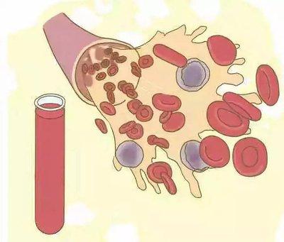 一直低烧怎么回事？

一直低热，可能是急性上呼吸道感染、肺结核、支原体感染、血液