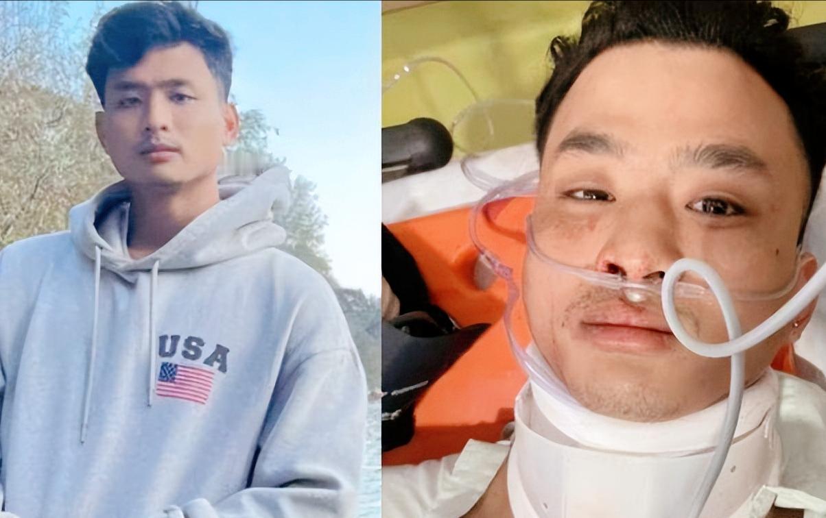 因长相像中国人遭围殴致死：印度民族主义阴影下的悲剧。

近期，印度 24 岁青年