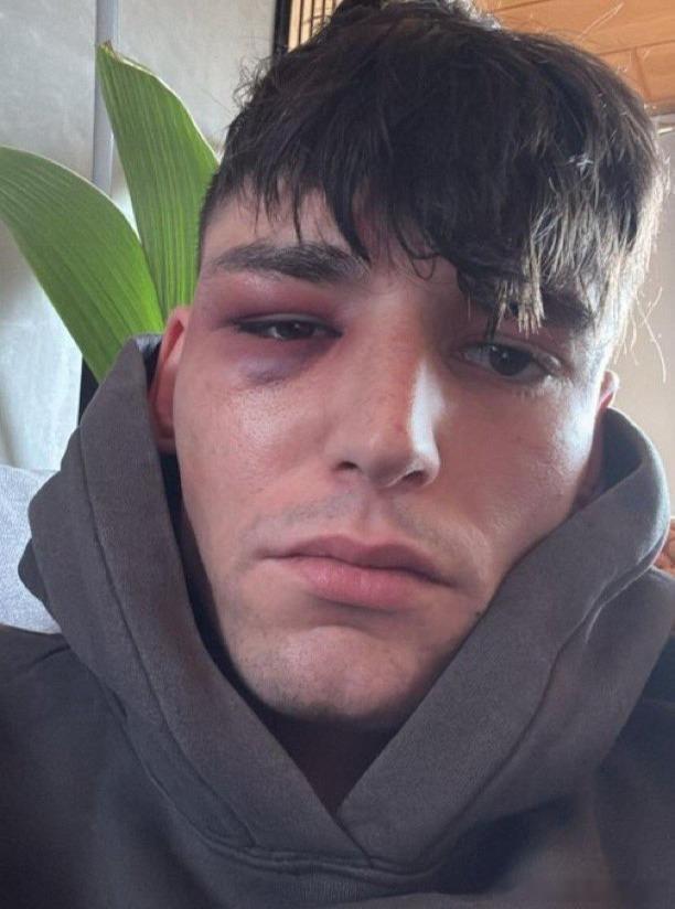 有反转？德国足球裁判帕斯卡尔·凯泽在科隆比赛前向同性伴侣求婚，此后10天内遭遇两