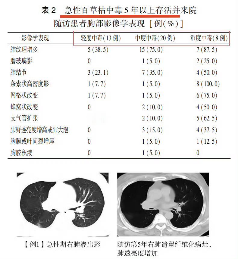 情人喂百草枯毒死算命先生被判14年 明显的故意杀人罪，只判了14年！减刑以后很快