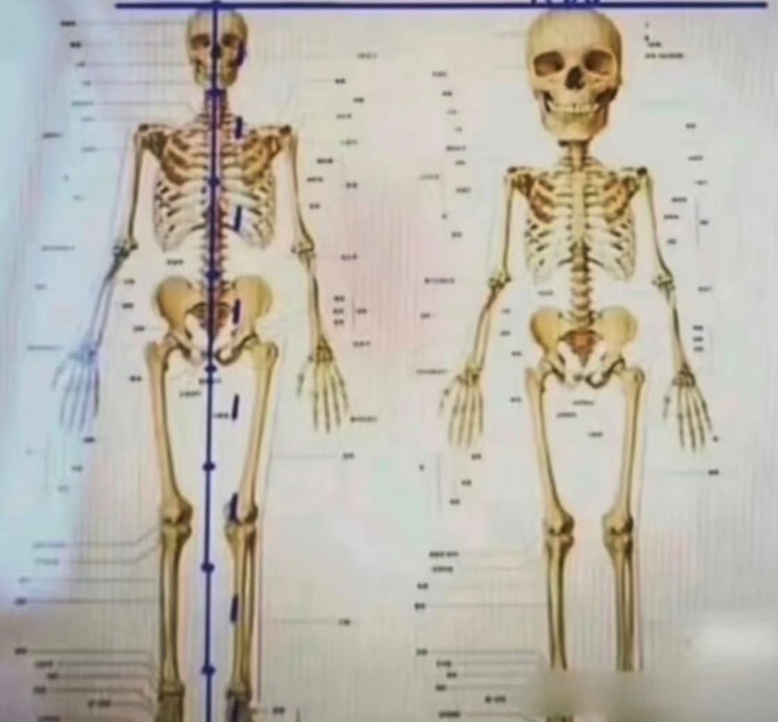 比起现在日渐僵硬的脸蛋，比例才是硬伤，那小短腿 ​​​