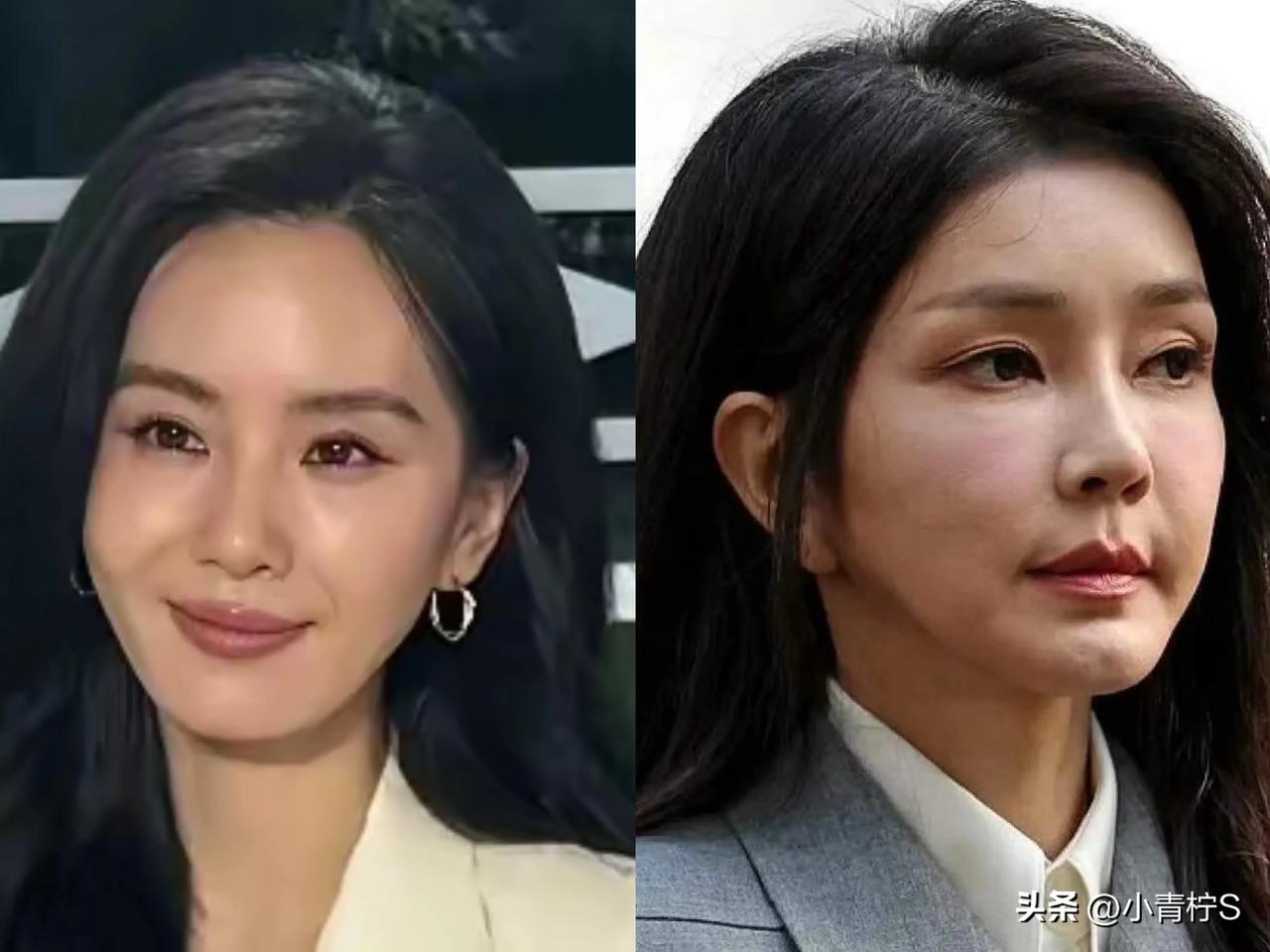 像不像同一家医院出来的，只是前者还没有后者那么僵[看]


#明星相似度探讨# 