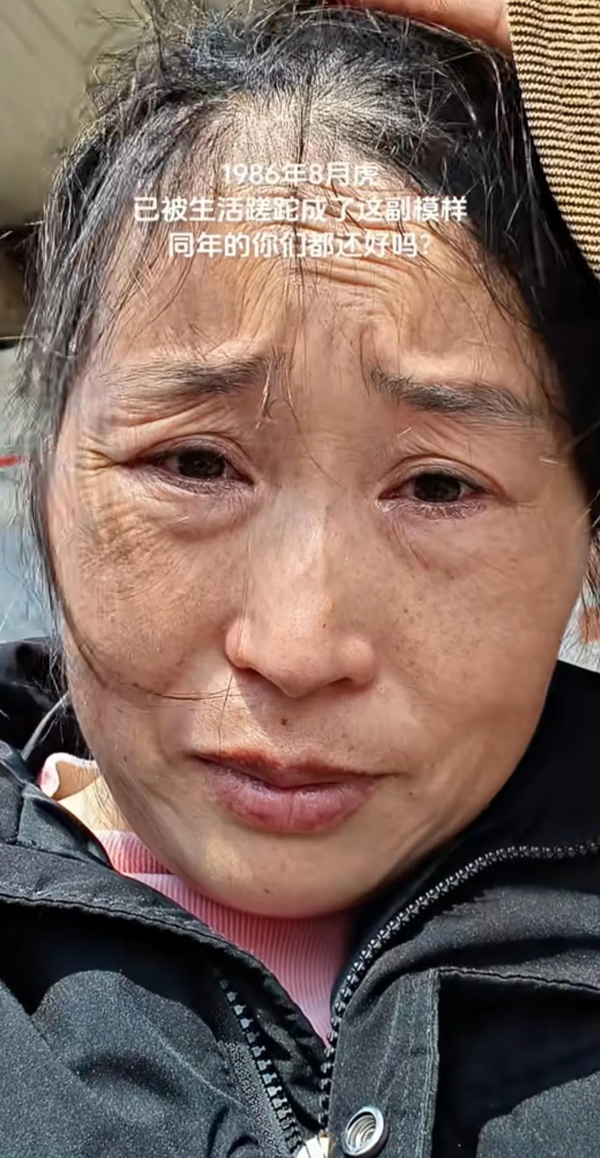 86年的女人，才40岁，咋就老成了这样子，满脸皱纹，像70多岁的老太太，也许是生