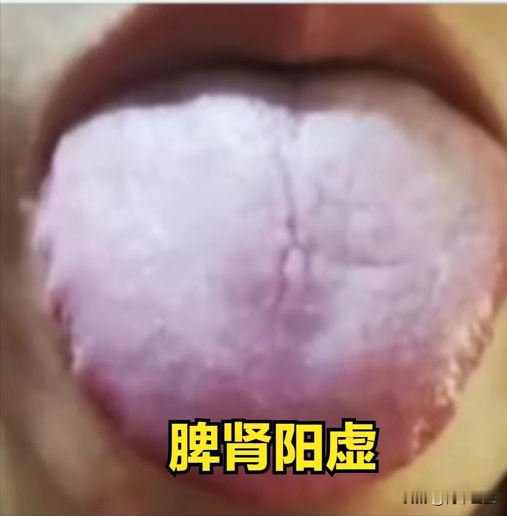 桂附地黄芄得这样用，不仅补肾阳，还能健脾，阴阳双调。学会了全家受益

1.桂附地