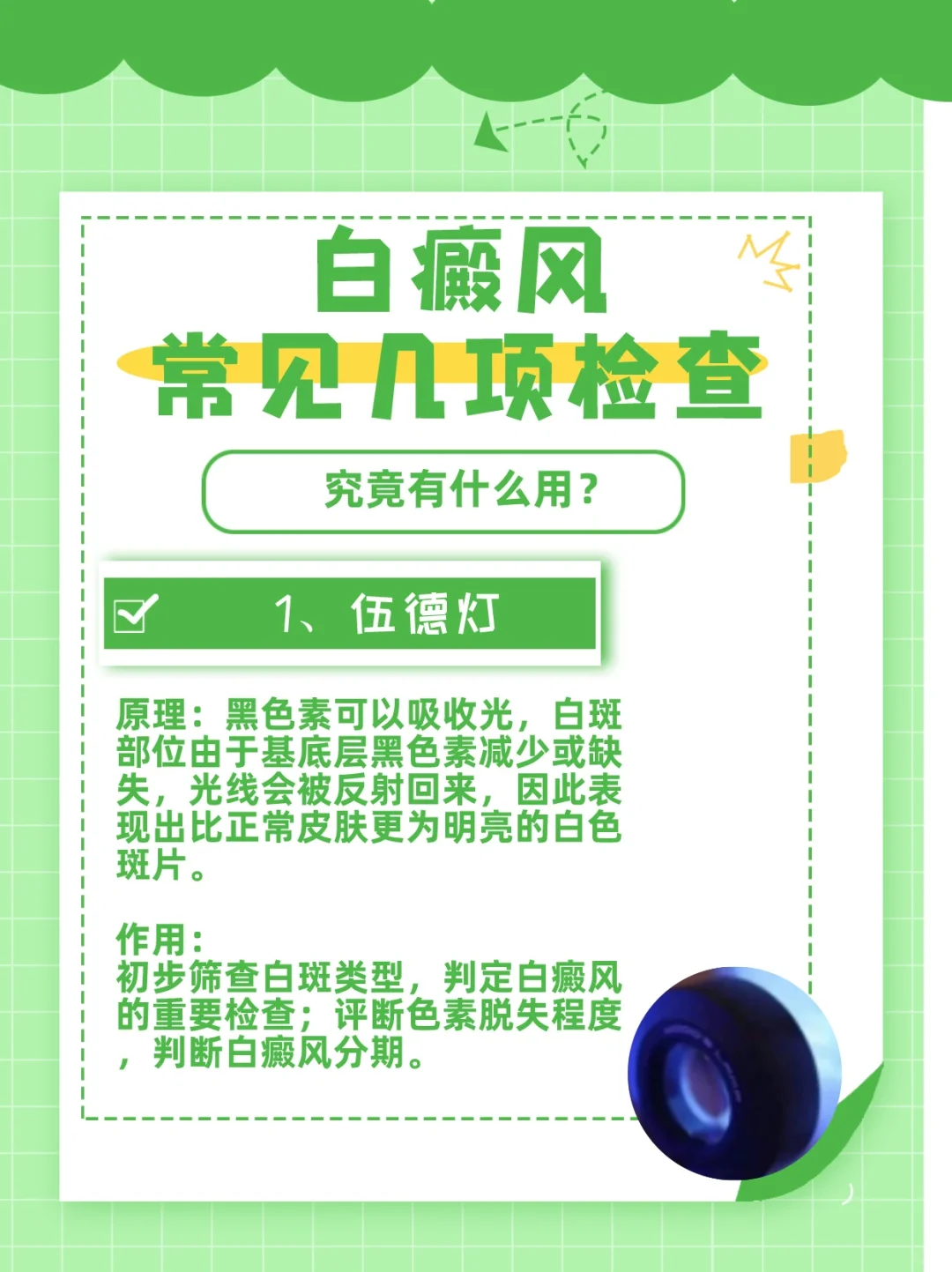 有白斑白癜风需要做哪些检查，有什么作用？
