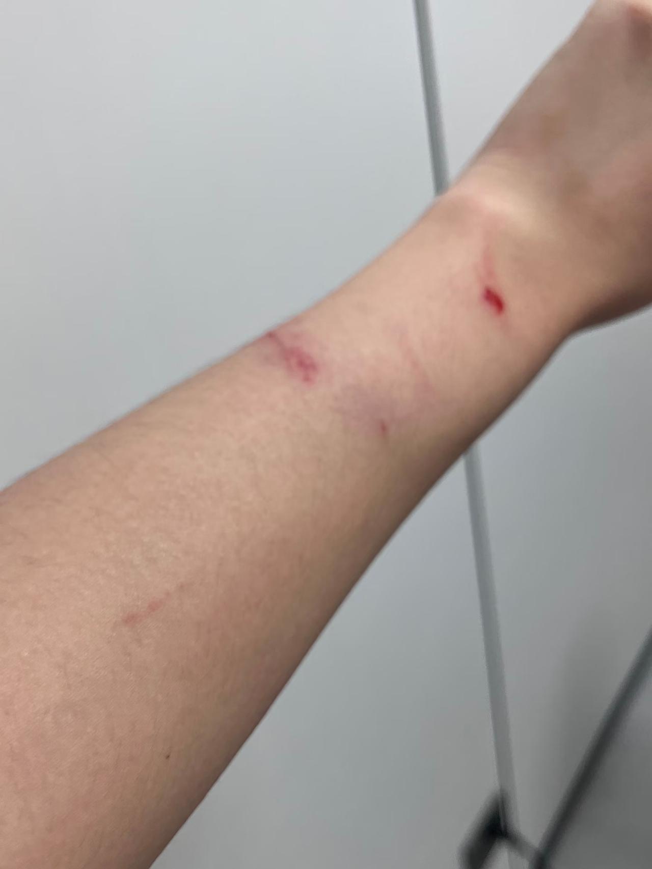 被亲哥打了

我同事说

他打人真的特别狠，一边疯狂骂很难听的脏话，一边对她拳打