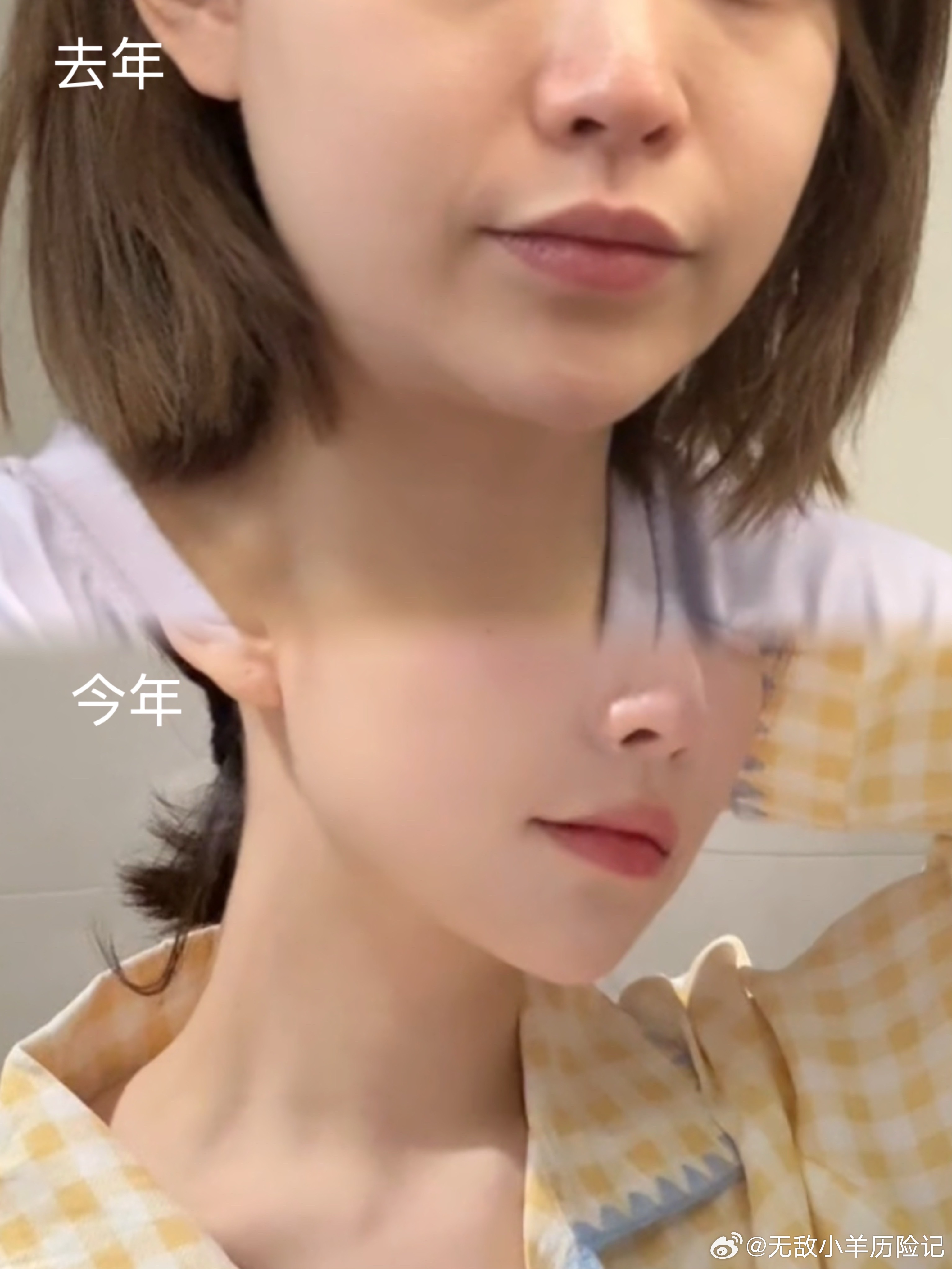 年前做的onda和索夫波不多说了，先放个对比这周五🍠播！比小韩便宜zhuan?