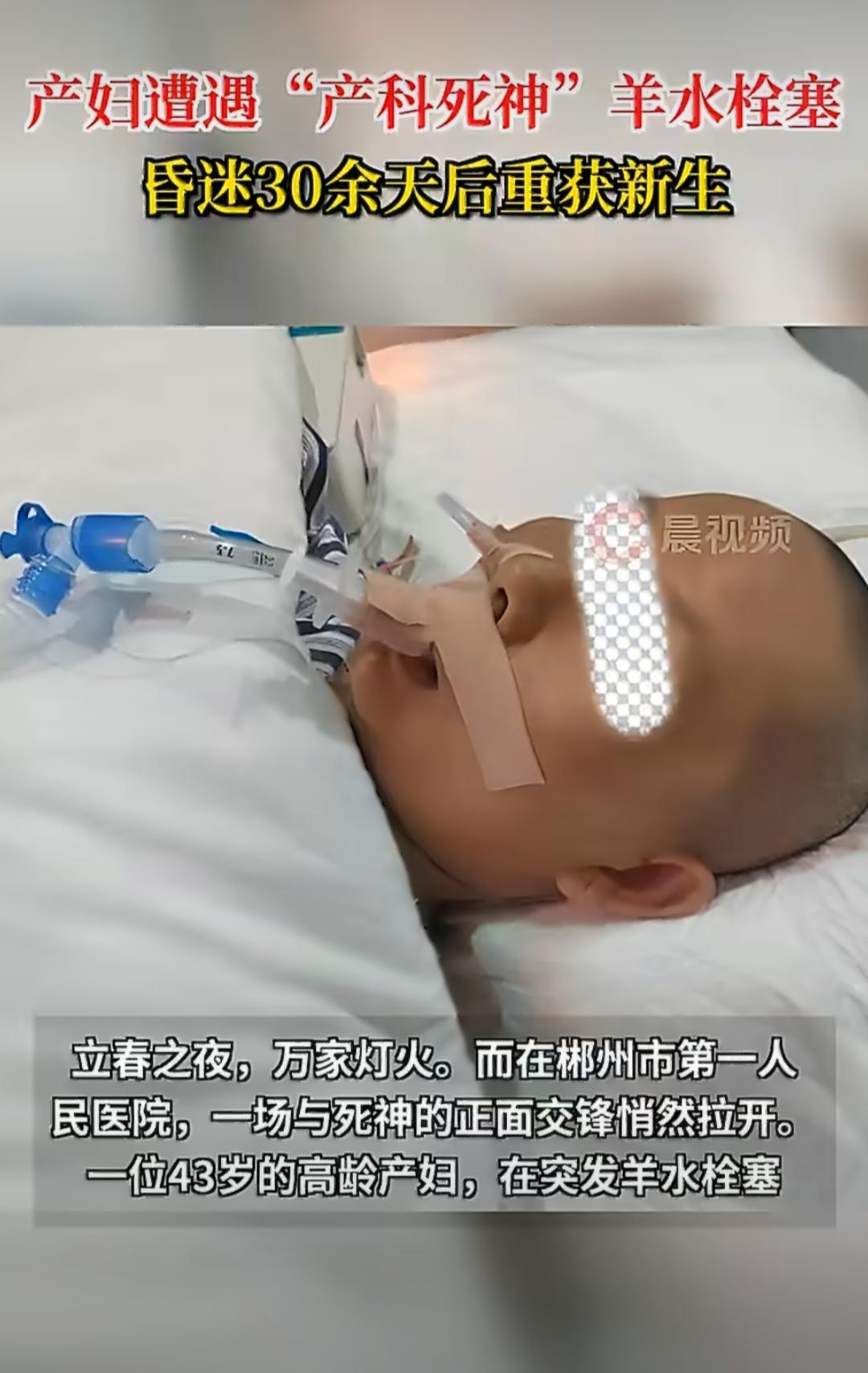 43岁产妇遭遇产科死神，昏迷三十余天终苏醒
 
一位43岁的高龄产妇，在分娩时遭