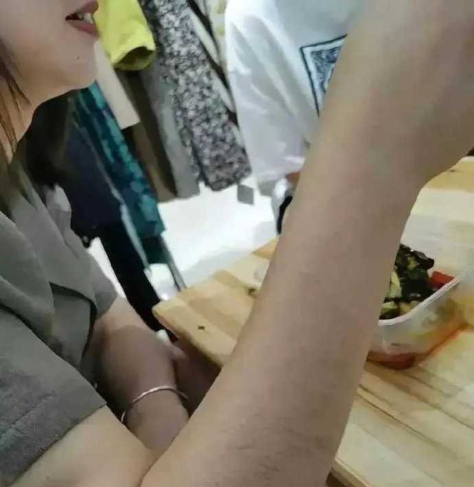 女孩子真的会汗毛这么重吗？ 