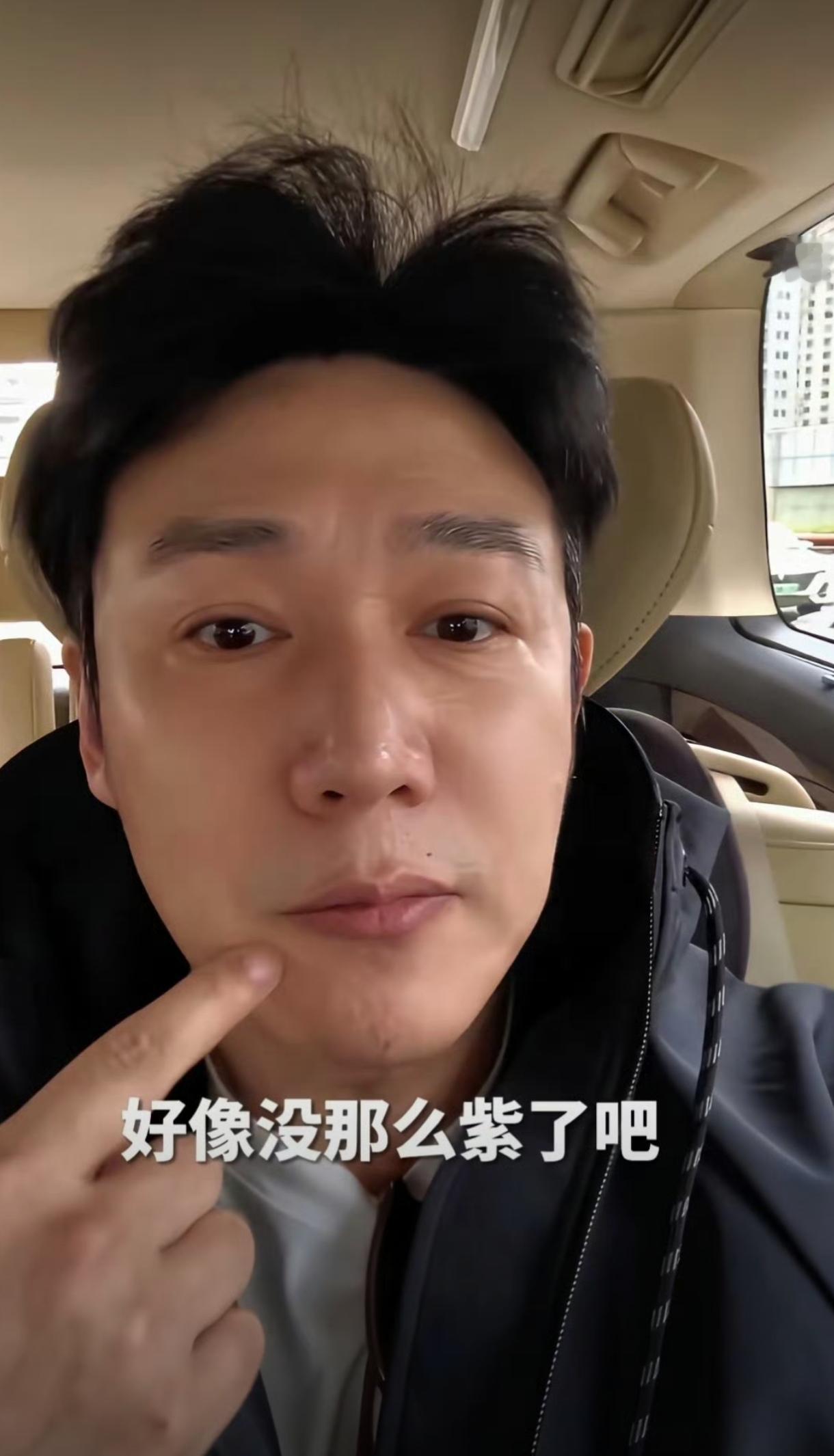 50岁陆毅最近因为嘴唇发紫的状态，被一众网友和粉丝疯狂操心身体状况。大家都不停暖