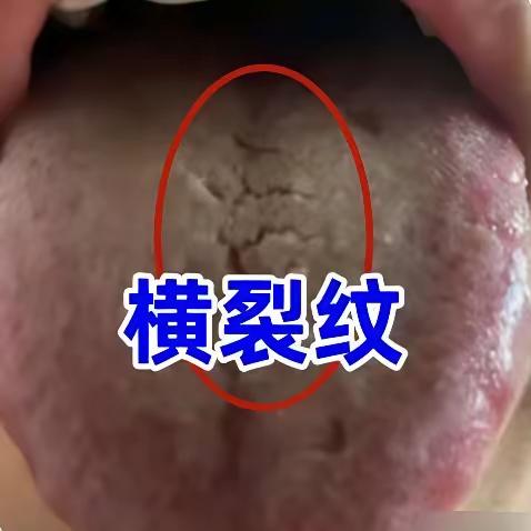 分不清肾精亏虚病根？阴虚分燥热，阳虚分寒凝，两类虚损分开调理
 
大家好，我是徐
