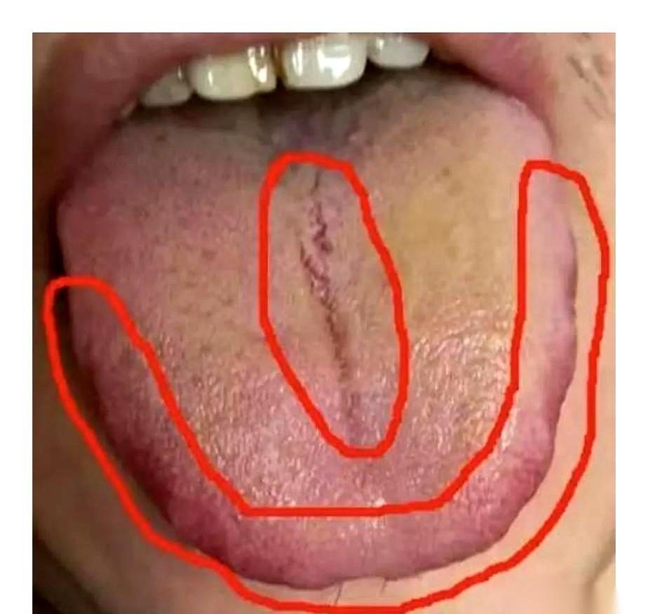 就那张舌头，还敢靠“小药丸”硬撑，不要命了？
真不是我吓唬人，一个四十岁的哥们，