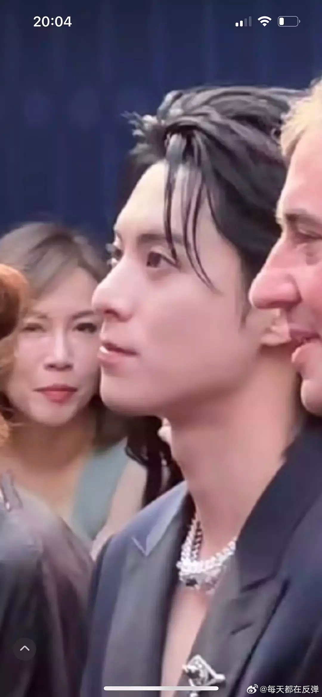 王鹤棣小兰花还有替身文学王鹤棣这个反颌怎么越来越严重了眼睛和嘴巴都越来越凸了 ​