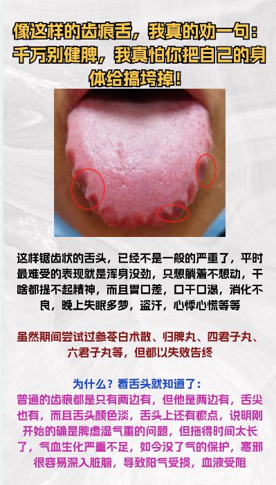 像这样的舌象，真的不要再健脾了，真怕把身体搞垮