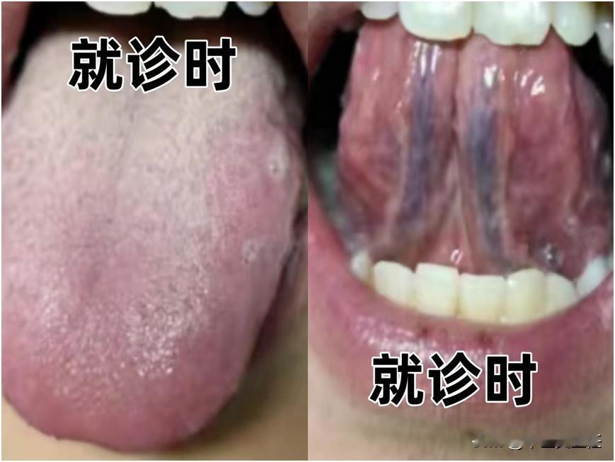 跑了几千公里，前来求医，结果几味药就给解决了，药费还没有路费贵！
这位朋友从广东