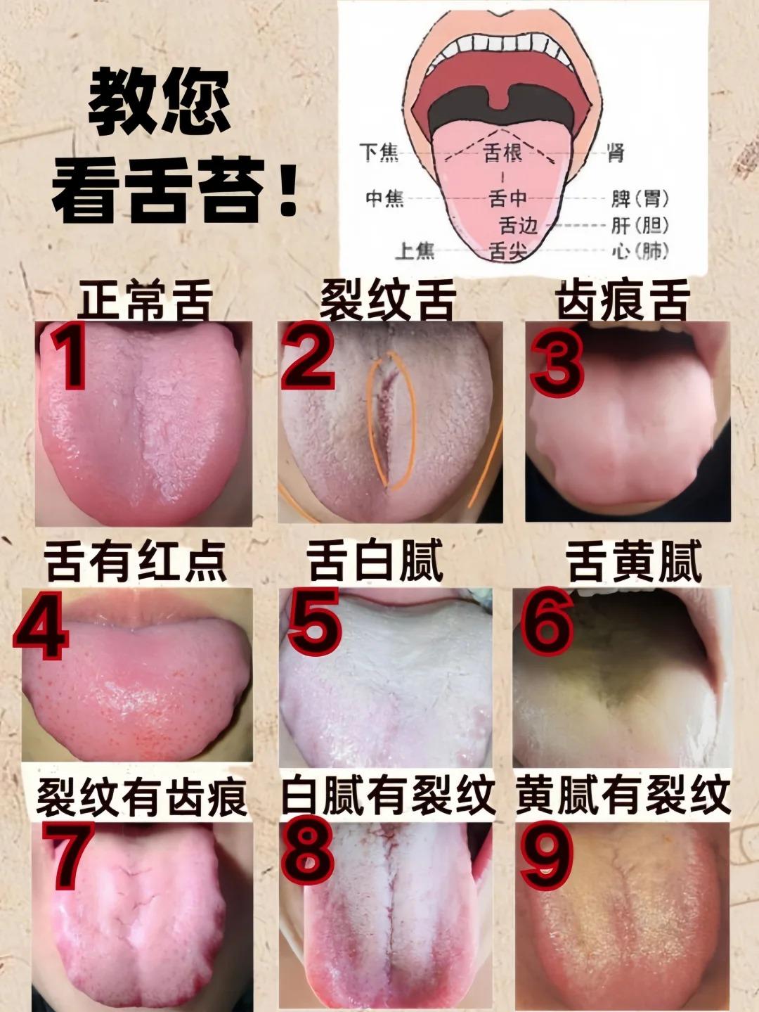 本月中医舌诊挑战第6天！！！

今天继续挑战1天看30个舌象，你发过来，我直接出