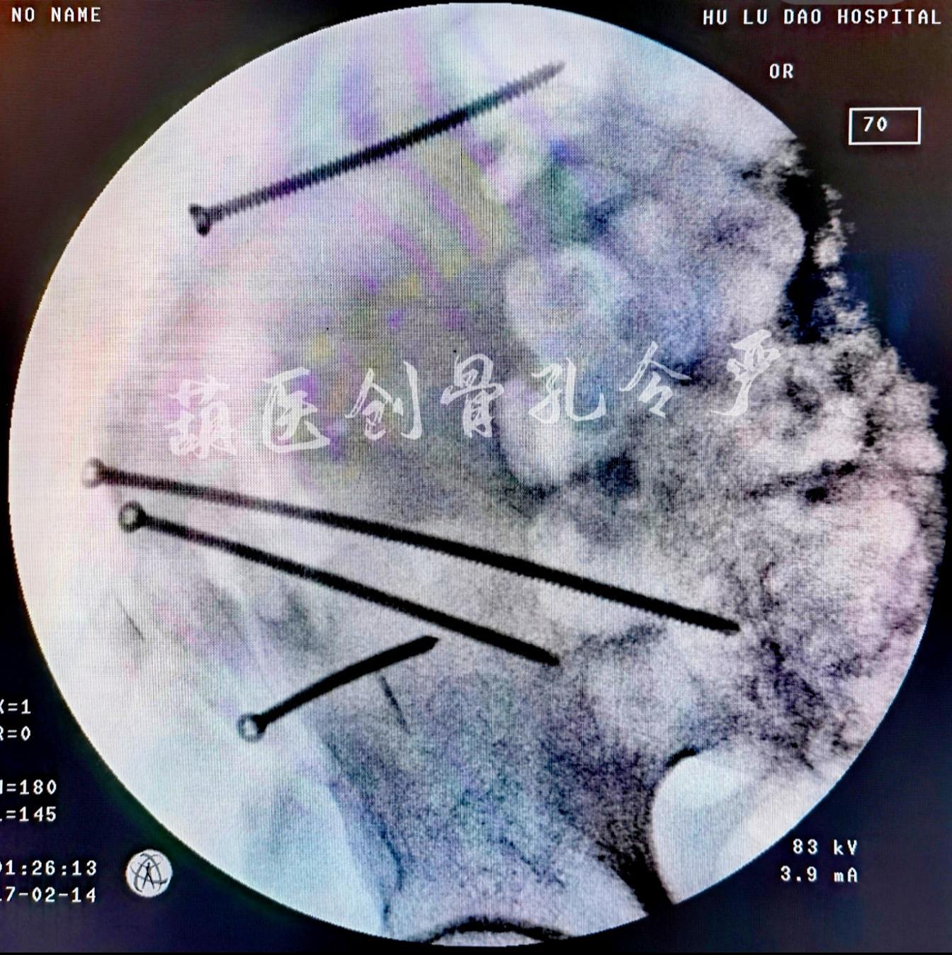 四颗钉子八十元，到最后，支撑技术的还是情怀和热爱！