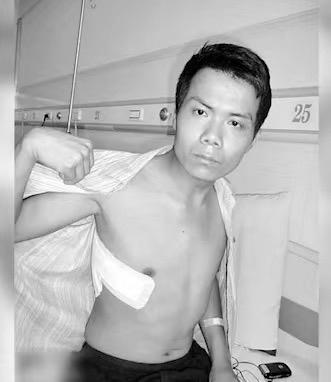 【#开胸验肺16年后当事人现状#：说起生活泪流不止，但好好活着仍是他的责任丨在场