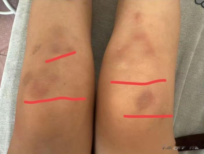 鄂尔多斯讨薪女子遭毒打半小时：被拖进办公室施暴、逼写假收条，老板夫妻竟当场逃遁！