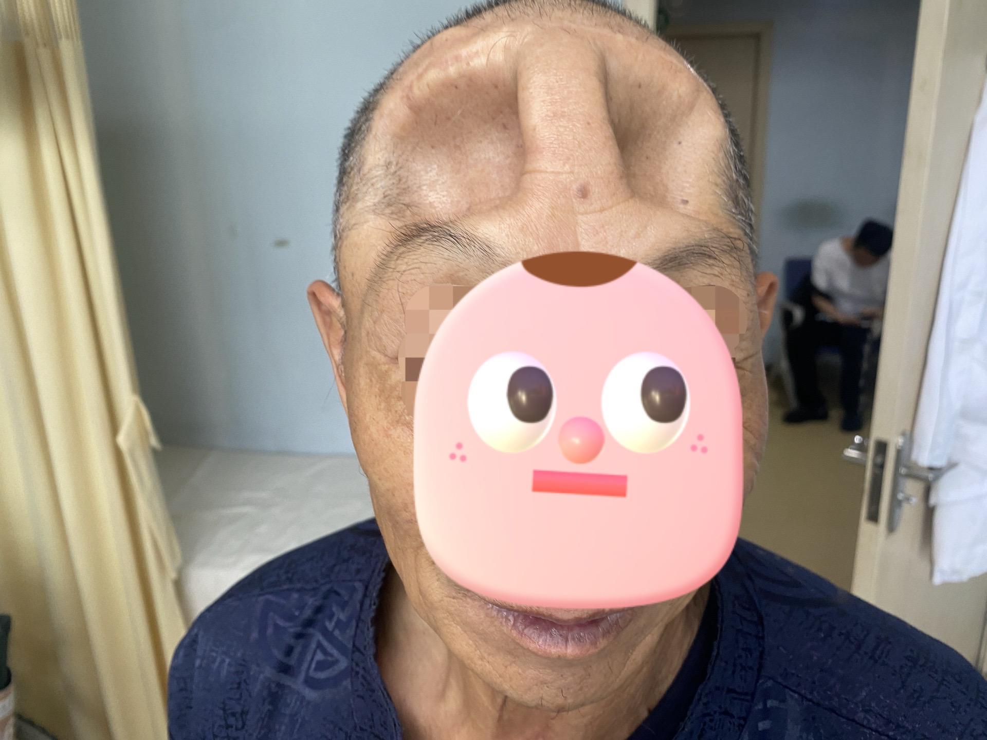 神奇的人体。九死一生中救活，救醒，还救到能自理，离不开急救，手术，康复...