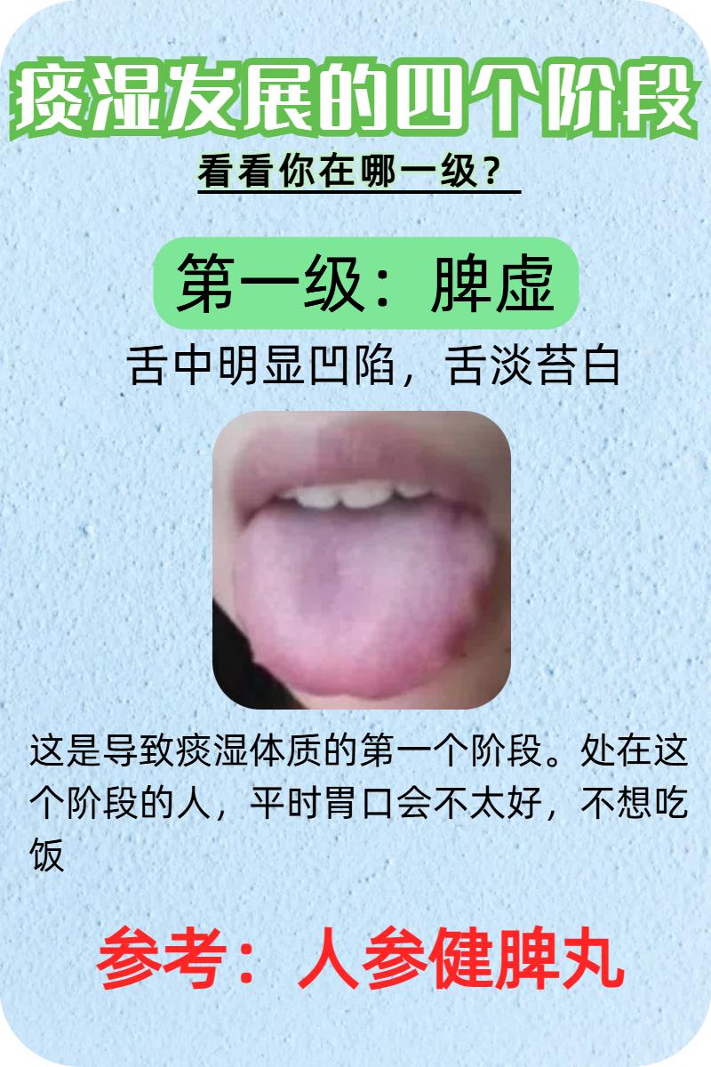 痰湿发展分等级，看看你在哪一级？

第一级：脾虚

第二级：脾虚湿盛

第三级：