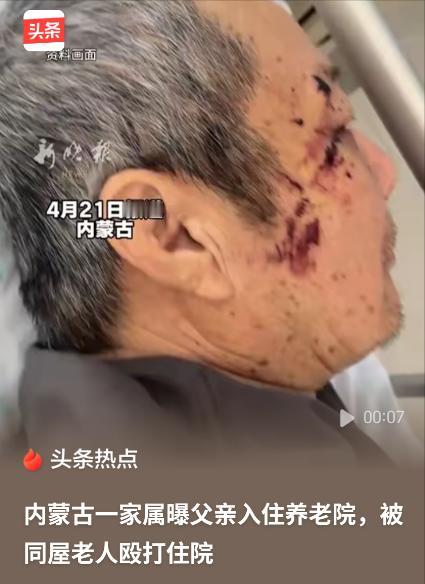 养老院成了挨打院？女儿去养老院接父亲，发现老人全身带伤、衣服破烂，整个人都是骚的
