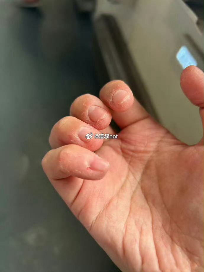 因月经弄脏火车卧铺床单被要求赔偿180元的当事人，已以兰州客运段发布的情况说明存