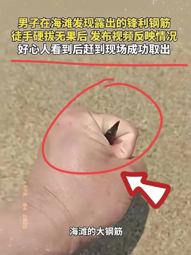 “积大德了！”一男子在海滩游玩，突然发现沙地里露出一截钢筋，尖头朝上，看着就吓人