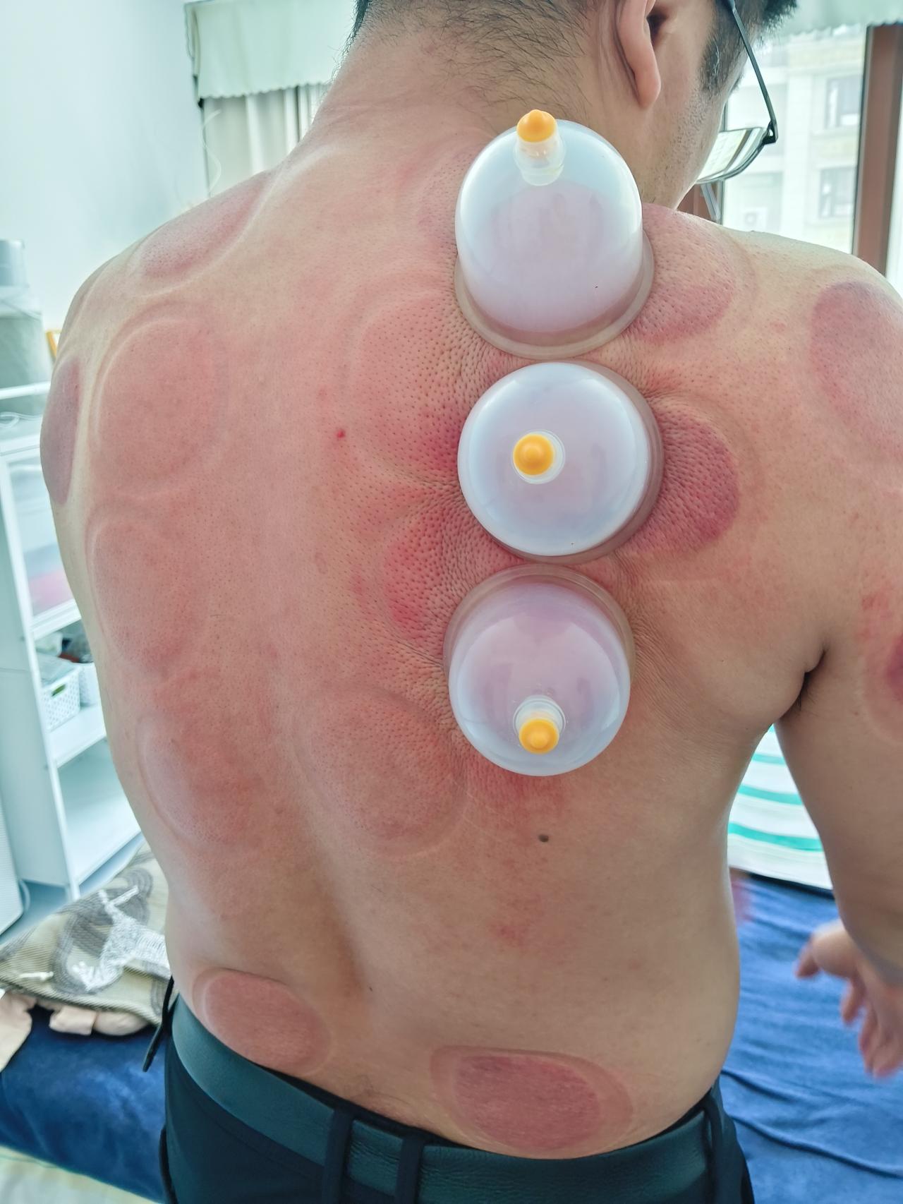 今天上午接一个上门的顾客，大哥肩膀不舒服，说已经十多年了，问我能不能z好，其实就