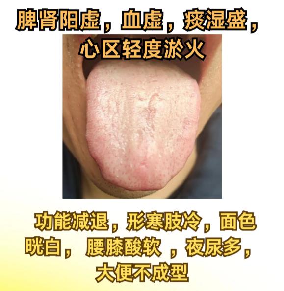 3 种男性体虚舌象，中医辨证调理思路