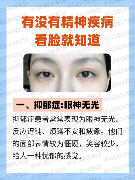 有没有精神疾病，看脸就知道 	 ﻿精神疾病﻿ ﻿精神分裂﻿ ﻿中医﻿ ...