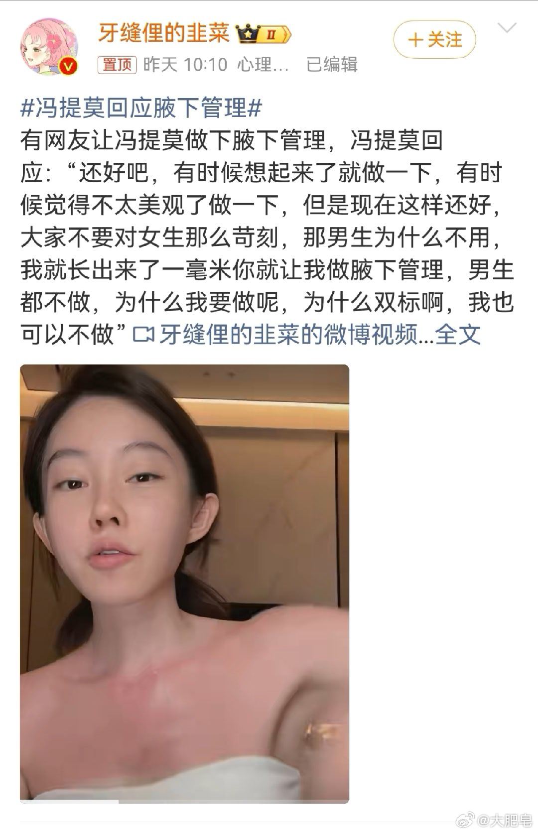 冯提莫回应腋下管理 我怎么感觉她样子又变了…… 