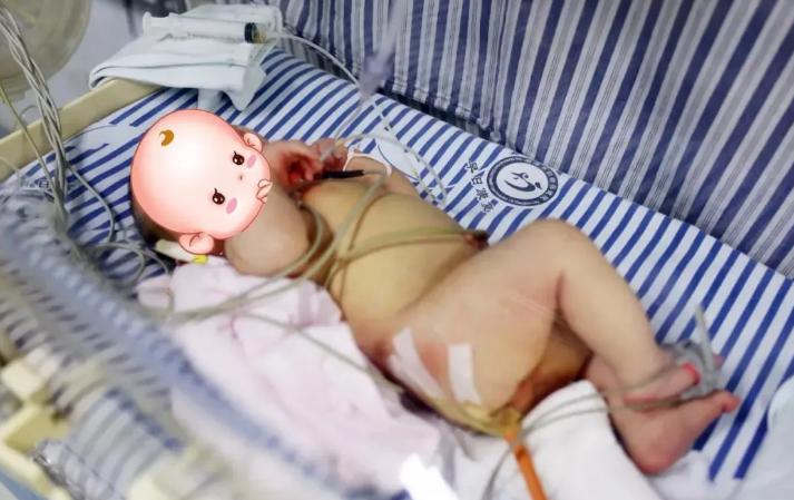 29岁产妇顺产生下一个足月大胖小子，全家还没来得及高兴，接产医生一翻裤裆当场愣住